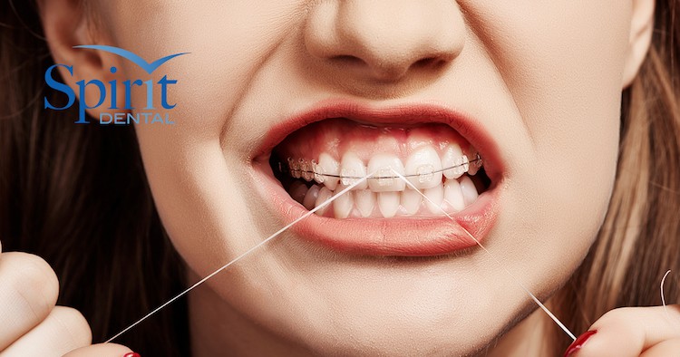 Lady flossing her braces