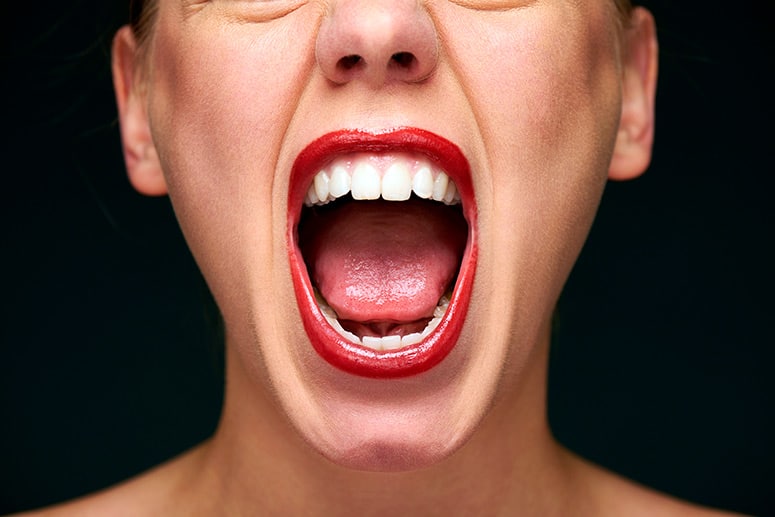 Lady opening her mouth wide to show her teeth