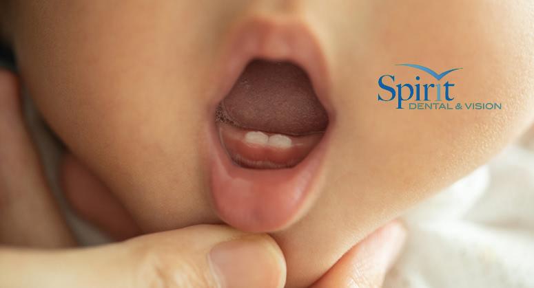 Dentist opening babies mouth to look at teeth