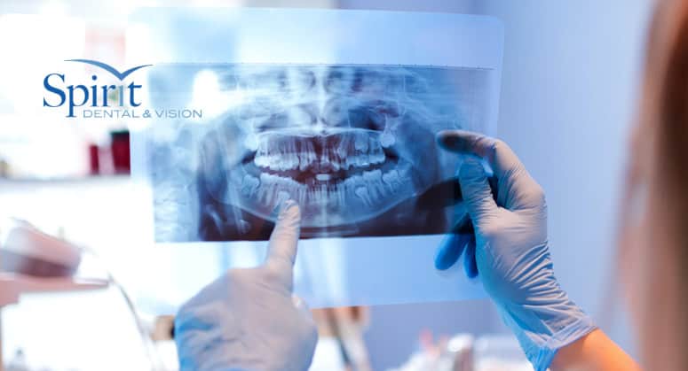 Doctor looking at tooth x-ray.