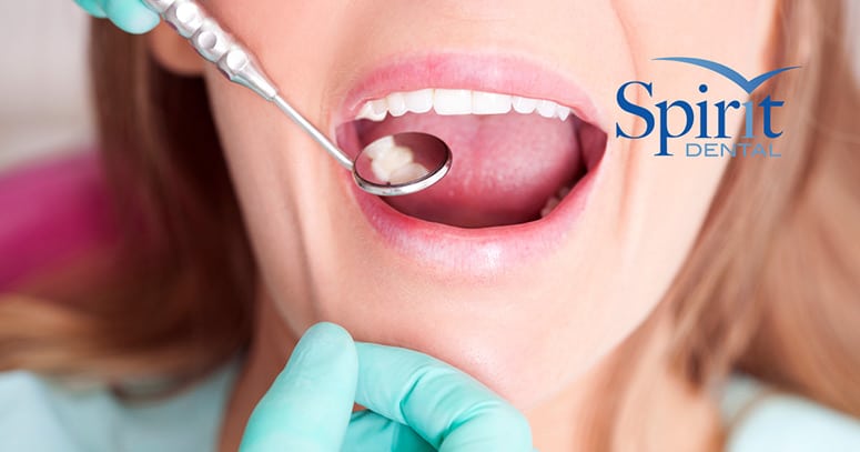 Dentist looking at fillings in woman's mouth with a mirror.